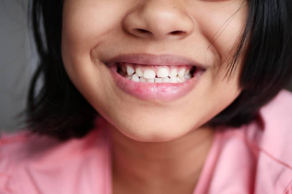 child smiling with healthy white teeth.